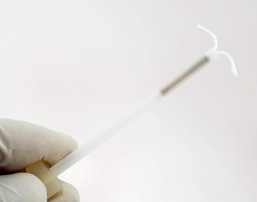 Mirena IUD Birth Control Lawsuits